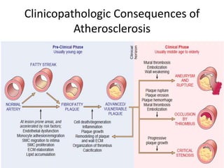 Clinicopathologic Consequences of
Atherosclerosis
 