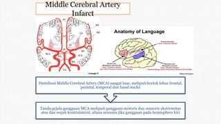 Middle Cerebral Artery
Infarct
Tanda gejala gangguan MCA meliputi gangguan motoris dan sensoris ekstremitas
atas dan wajah kontralateral, afasia sensoris jika gangguan pada hemisphere kiri
Distribusi Middle Cerebral Artery (MCA) sangat luas, meliputi kortek lobus frontal,
parietal, temporal dan basal nuclei
 