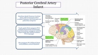 Posterior Cerebral Artery
Infarct
Distribusi darah Posterior Cerebral
Artery (PCA) menuju ke lobus
occipital, thalamus dan beberapa area
pada lobus temporal
Tanda gejala klinis gangguan PCA
meliputi homonymus hemianopia,
hypersomnolence, gangguan sensoris
dapat terjadi jika cabang terdalam
PCA terganggu
Jika gangguan PCA bilateral dapat
menyebabkan cortical blindness
 