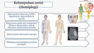 Kelumpuhan sesisi
(Hemiplegi)
Kelumpuhan khas lesi UMN :
hipertonus, hiperrefleks &
spastis
Hipertonus pada otot antigravity
(fleksor-ekstremitas atas &
ekstensor ekstremitas bawah)
Muncul pola abnormal sinergis
Hilangnya kemampuan gerakan
terampil
 