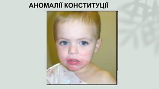 АНОМАЛІЇ КОНСТИТУЦІЇ
 