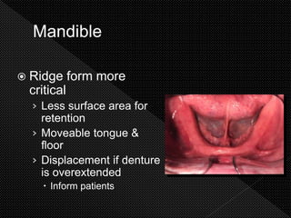 5. complete denture diagnosis.pptx