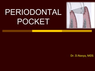 PERIODONTAL
POCKET
Dr. D.Navya, MDS
 