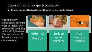 Interstitial Radiotherapy 5. radiotherapy and chemotherapy-doaa elkady.pptx