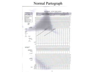 5.1 Partograph.ppt