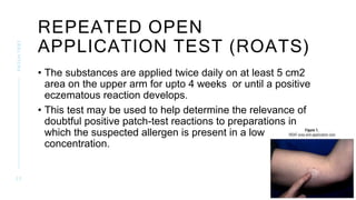 Patch Test in Dermatology | PPTX