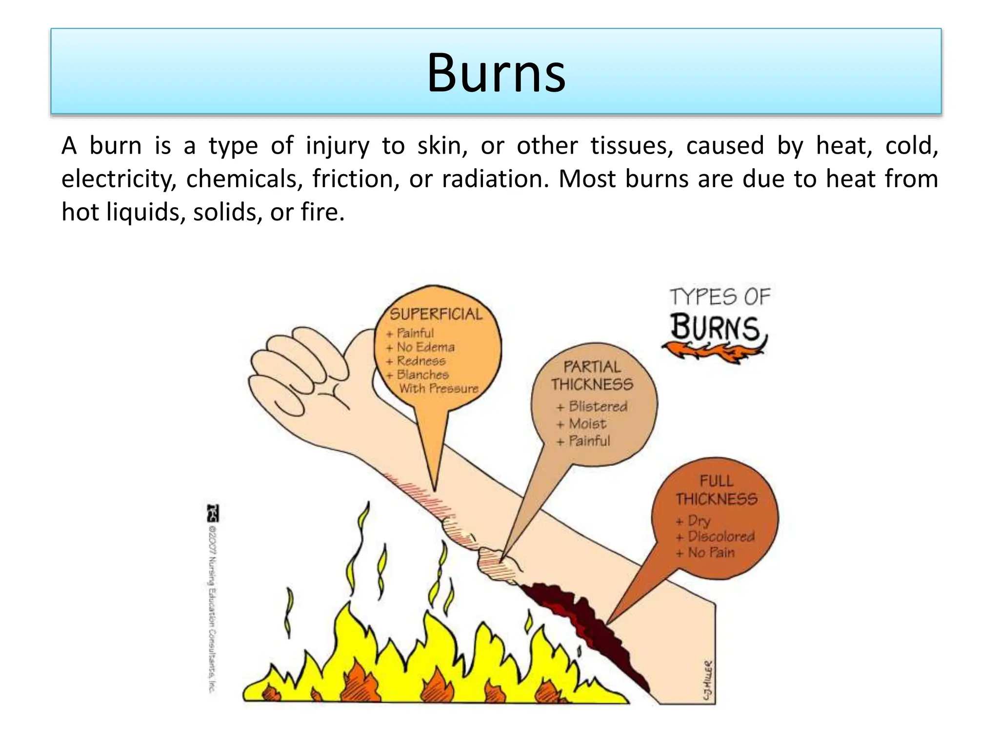 Solid Burn 5. Burns. Frostbite. Electrical injury-1.pptx