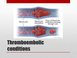 Thromboembolic
conditions
 
