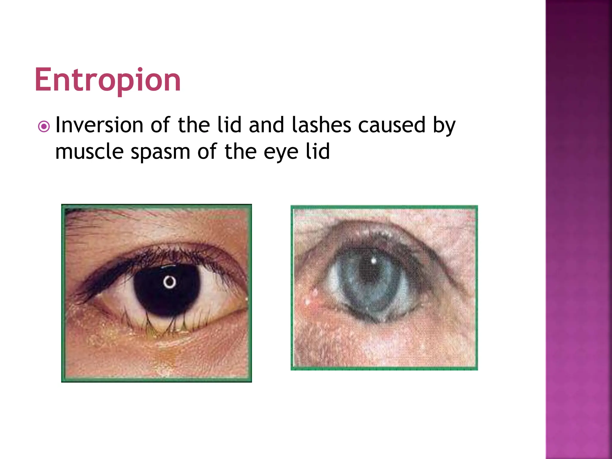 5. Eye Assessment.ppt Nursing Student Content | PPT