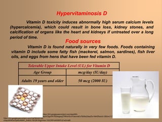 Hypervitaminosis D
Vitamin D toxicity induces abnormally high serum calcium levels
(hypercalcemia), which could result in bone loss, kidney stones, and
calcification of organs like the heart and kidneys if untreated over a long
period of time.
Tolerable Upper Intake Level (UL) for Vitamin D
Age Group mcg/day (IU/day)
Adults 19 years and older 50 mcg (2000 IU)
Food sources
Vitamin D is found naturally in very few foods. Foods containing
vitamin D include some fatty fish (mackerel, salmon, sardines), fish liver
oils, and eggs from hens that have been fed vitamin D.
https://lh3.googleusercontent.com/OqP8KA5i7nN-
chayu0KkEbcGpdEoNbM1_0ci6UL7zEQ91WgjVHce-13OCRPn4W9WFc21eQ=s85
https://lh3.googleusercontent.com/4aqrMIX-
6pxVCfgoVKYR24wgwqZ7RKoHSv3YskxmbExTBS9x23eaZ5v1MirfZNub3i-CBQ=s117
 