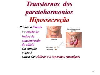 Transtornos dos
paratohormonios
Hipossecreção
Produz a tetania
ou queda do
índice de
concentração
do cálcio
em sangue,
o que é
causa das cãibras e o espasmos musculares.
38
 