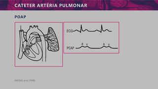 CATETER ARTÉRIA PULMONAR
POAP
(MCGEE et al, 2009)
 
