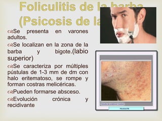 5.-PIODERMITIS, concepto y diagnostico.. | PPTX