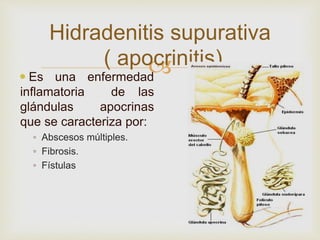 5.-PIODERMITIS, concepto y diagnostico.. | PPTX