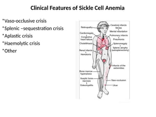 Hemoglobinopathies (thalassemia and SCA) | PPTX