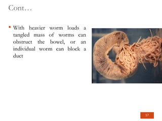 Cont…
 With heavier worm loads a
tangled mass of worms can
obstruct the bowel, or an
individual worm can block a
duct
17
 
