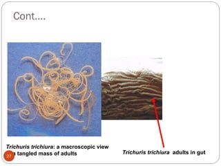 Cont….
Trichuris trichiura adults in gut
Trichuris trichiura: a macroscopic view
of a tangled mass of adults
27
 