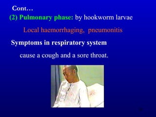 (2) Pulmonary phase: by hookworm larvae
Local haemorrhaging, pneumonitis
Symptoms in respiratory system
cause a cough and a sore throat.
Cont…
62
 