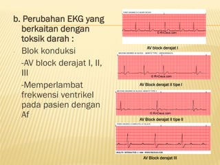 GAMBARAN EKG DASAR, EKG LAIN SESUAIKAN.. | PPT