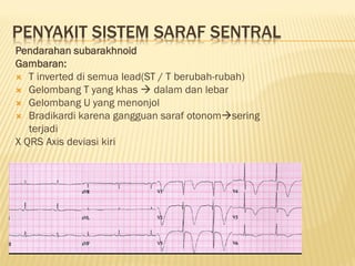 GAMBARAN EKG DASAR, EKG LAIN SESUAIKAN.. | PPT