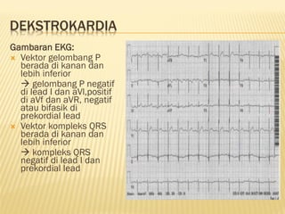 GAMBARAN EKG DASAR, EKG LAIN SESUAIKAN.. | PPT