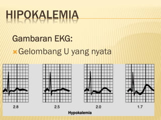 GAMBARAN EKG DASAR, EKG LAIN SESUAIKAN.. | PPT