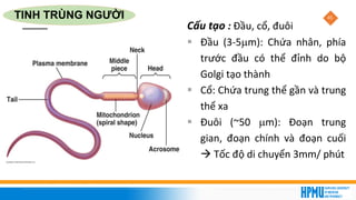 45
Cấu tạo : Đầu, cổ, đuôi
▪ Đầu (3-5m): Chứa nhân, phía
trước đầu có thể đỉnh do bộ
Golgi tạo thành
▪ Cổ: Chứa trung thể gần và trung
thể xa
▪ Đuôi (~50 m): Đoạn trung
gian, đoạn chính và đoạn cuối
→ Tốc độ di chuyển 3mm/ phút
TINH TRÙNG NGƯỜI
 