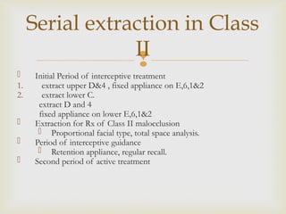 5.SERIAL EXTRACTION.ppt lecture class.ppt