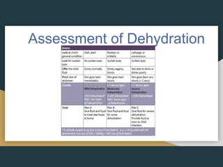 Assessment of Dehydration
 