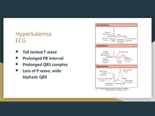 Hyperkalemia
ECG
● Tall tented T wave
● Prolonged PR interval
● Prolonged QRS complex
● Loss of P wave, wide
biphasic QRS
 