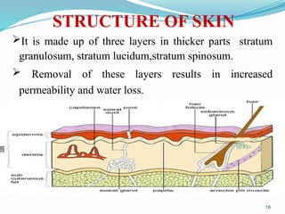 It is made up of three layers in thicker parts stratum
granulosum, stratum lucidum,stratum spinosum.
 Removal of these layers results in increased
permeability and water loss.
16
STRUCTURE OF SKIN
 
