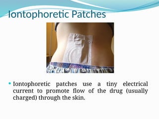 Iontophoretic Patches
 Iontophoretic patches use a tiny electrical
current to promote flow of the drug (usually
charged) through the skin.
 
