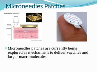 Microneedles Patches
 Microneedles patches are currently being
explored as mechanisms to deliver vaccines and
larger macromolecules.
 