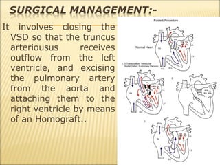 Truncus Methods 5.HLHS, truncus arteriosus, TOTAL ANOMALOUS pulmonary vessels-.ppt