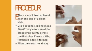 PROCEDUR
EPlace a small drop of blood
near one end of a clean
slide.
Use a second slide held at a
30–45° angle to spread the
blood drop evenly across
the first slide. Ensure a thin,
feathered edge is formed.
Allow the smear to air-dry.
 