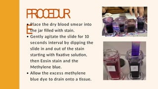 PROCEDUR
E
Place the dry blood smear into
the jar filled with stain.
Gently agitate the slide for 10
seconds interval by dipping the
slide in and out of the stain
starting with fixative solution,
then Eosin stain and the
Methylene blue.
Allow the excess methylene
blue dye to drain onto a tissue.
 