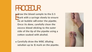 PROCEDUR
E
Draw the blood sample to the 0.5
mark with a syringe slowly to ensure
no air bubble will enter the pipette.
Once its done, carefully clean the
excess blood sticking to the outer
side of the tip of the pipette using a
cotton soaked with alcohol.
Carefully draw the WBC diluting
solution up to 1
1 mark on the pipette.
 