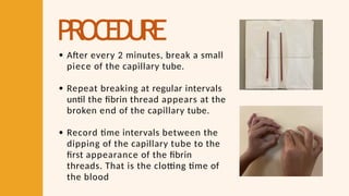 PROCEDURE
After every 2 minutes, break a small
piece of the capillary tube.
Repeat breaking at regular intervals
until the fibrin thread appears at the
broken end of the capillary tube.
Record time intervals between the
dipping of the capillary tube to the
first appearance of the fibrin
threads. That is the clotting time of
the blood
 
