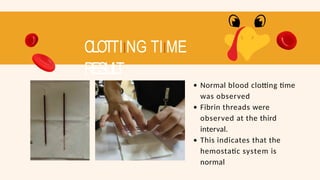 CLOTTIING TIIME
RESUL
T
Normal blood clotting time
was observed
Fibrin threads were
observed at the third
interval.
This indicates that the
hemostatic system is
normal
 