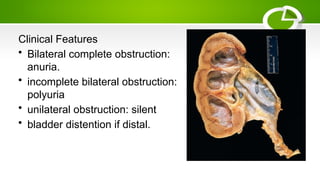 5.polycystic kidney diseasesnobstruction | PPTX