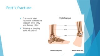 Pottys Fructure 5.Gene therapy for musculoskeletal system disorders.pptx