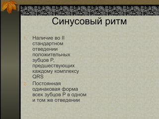 Синусовый ритм
1. Наличие во II
стандартном
отведении
положительных
зубцов Р,
предшествующих
каждому комплексу
QRS
2. Постоянная
одинаковая форма
всех зубцов Р в одном
и том же отведении
 