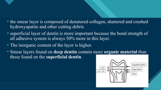 Smear Layer Modifications Smear LAYER in endodontics and conservative dentistr | PPTX