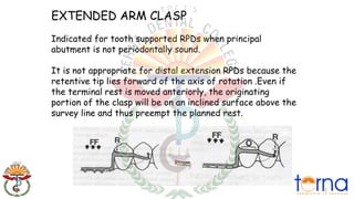 5.-direct-retainers in maxillofacial prosthodontics and removal ...