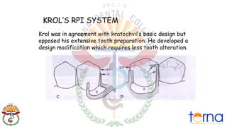 Krol Rpi Design 5.-direct-retainers in maxillofacial prosthodontics and removal ...