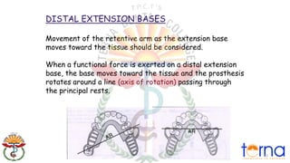 5.-direct-retainers in maxillofacial prosthodontics and removal ...