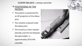 5.Elbow.pptx it is a ppt of a radiographic imaging | PPTX