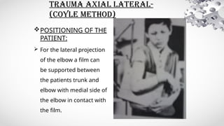 Lateral Coyle Method Routine 5.Elbow.pptx it is a ppt of a radiographic imaging | PPTX