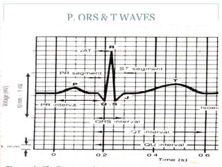 P, QRS & T WAVES
68
 