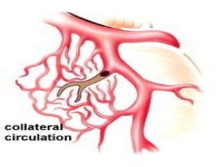 5.Cardiovascular disorders. pathophyisology semester 4 | PPTX